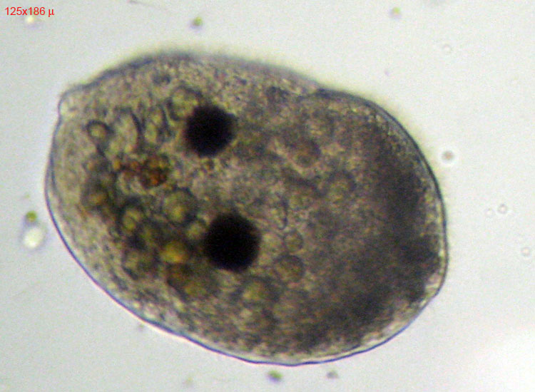 Tre Protozoi da identificare (se possibile)